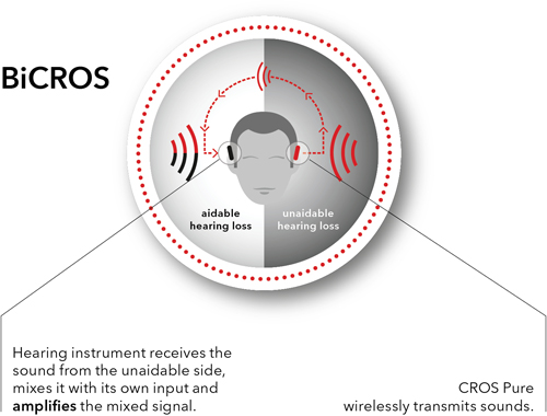 Bi-CROS visual explaining how a Bi-CROS system works