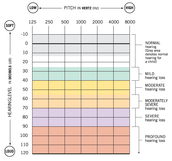 Blank Audiogram