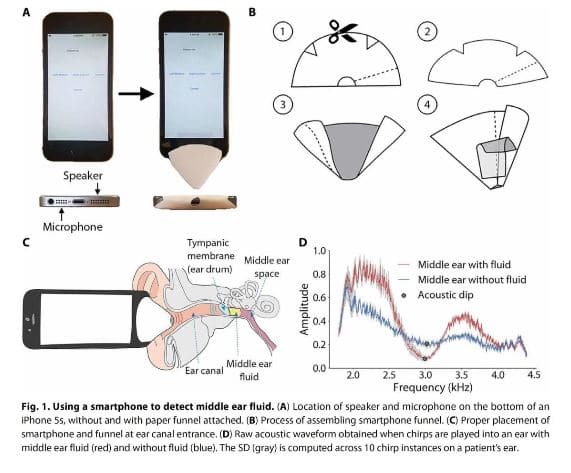 Smartphone Detection of Mid Ear Infection