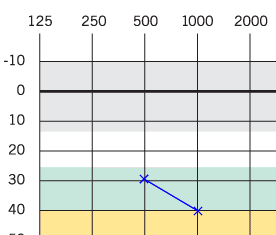 Blank Audiogram Chart