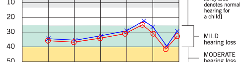 audiogram2