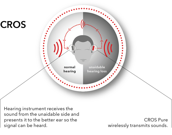 CROS and BiCROS Hearing Aids, Why, When and The Results