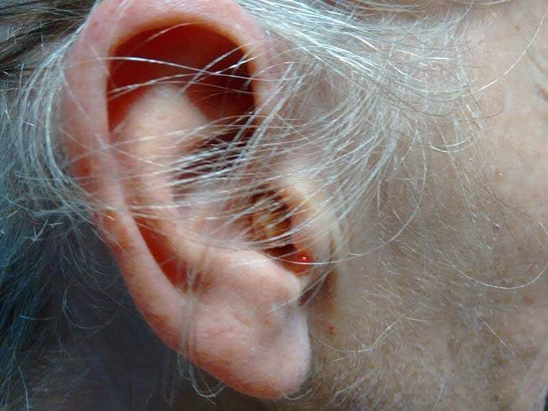 ear