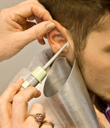 ear cleaning by irrigation earwax removal method