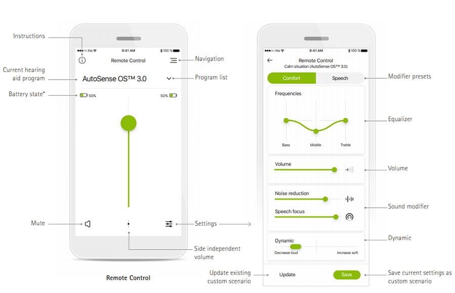 Phonak App Overview