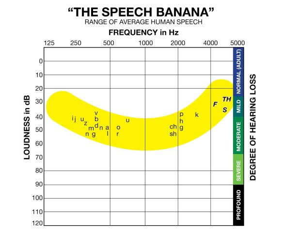 The Speech Bananna