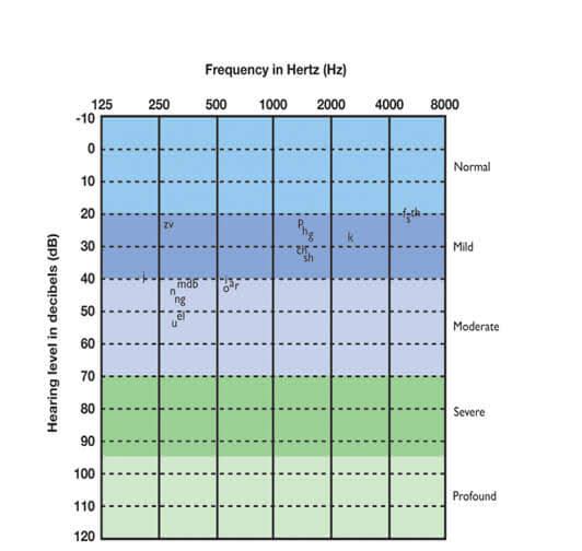 Audiogram Chart Blank